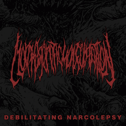 Morphogenetic Malformation : Debilitating Narcolepsy